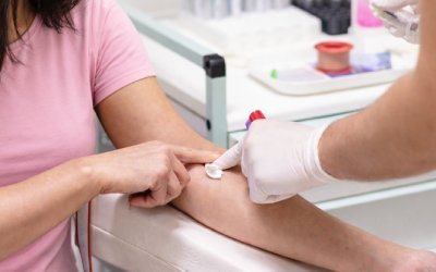 Gym female hormone blood test package at pathology lab and diagnostic centre